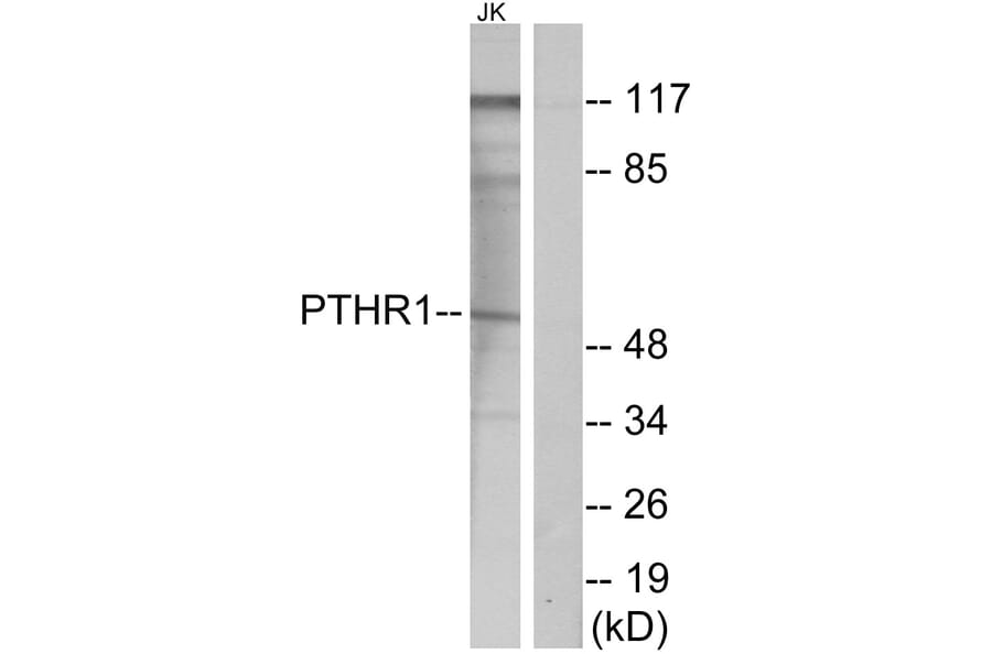 Western Blot - Anti-PTHR1 Antibody (G220) - Antibodies.com