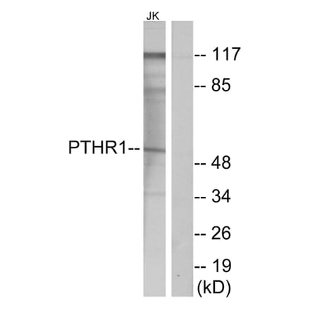 Western Blot - Anti-PTHR1 Antibody (G220) - Antibodies.com