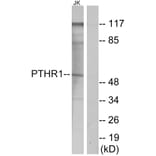 Western Blot - Anti-PTHR1 Antibody (G220) - Antibodies.com