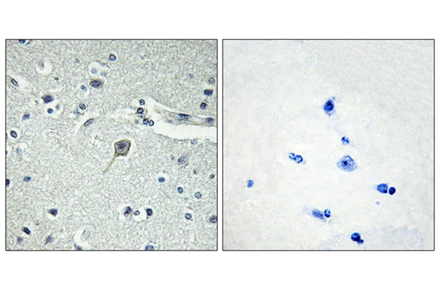 Immunohistochemistry - Anti-PTHR1 Antibody (G220) - Antibodies.com