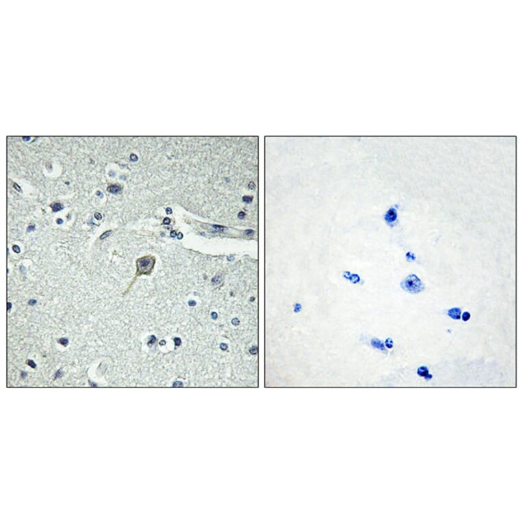 Immunohistochemistry - Anti-PTHR1 Antibody (G220) - Antibodies.com