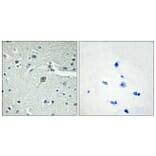 Immunohistochemistry - Anti-PTHR1 Antibody (G220) - Antibodies.com