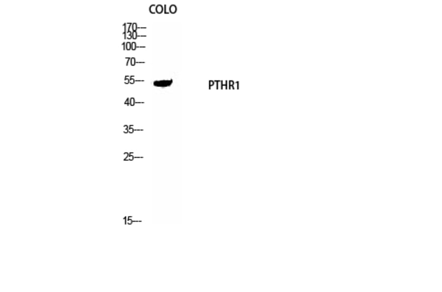 Western Blot - Anti-PTHR1 Antibody (G220) - Antibodies.com