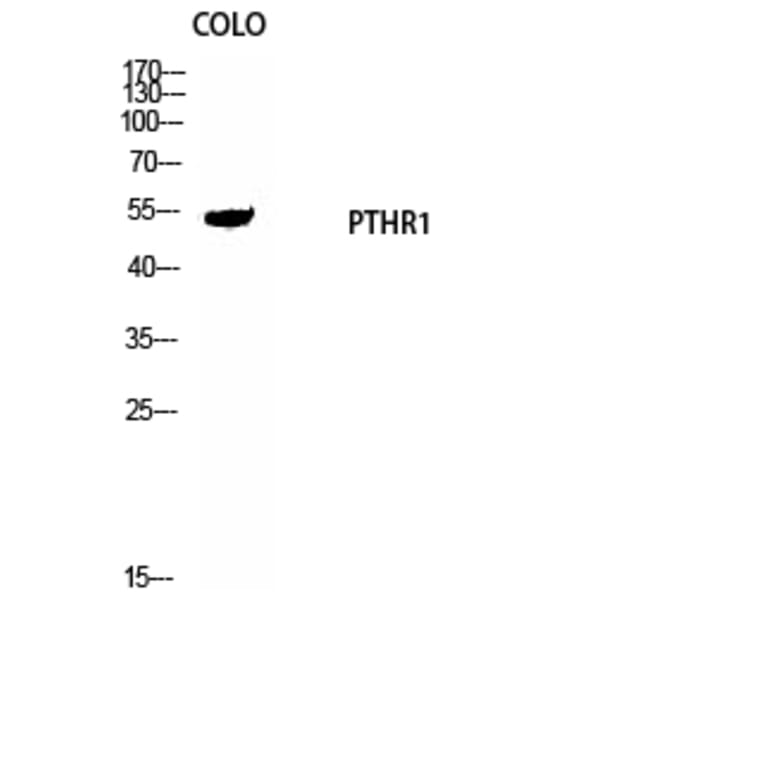 Western Blot - Anti-PTHR1 Antibody (G220) - Antibodies.com