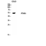 Western Blot - Anti-PTHR1 Antibody (G220) - Antibodies.com