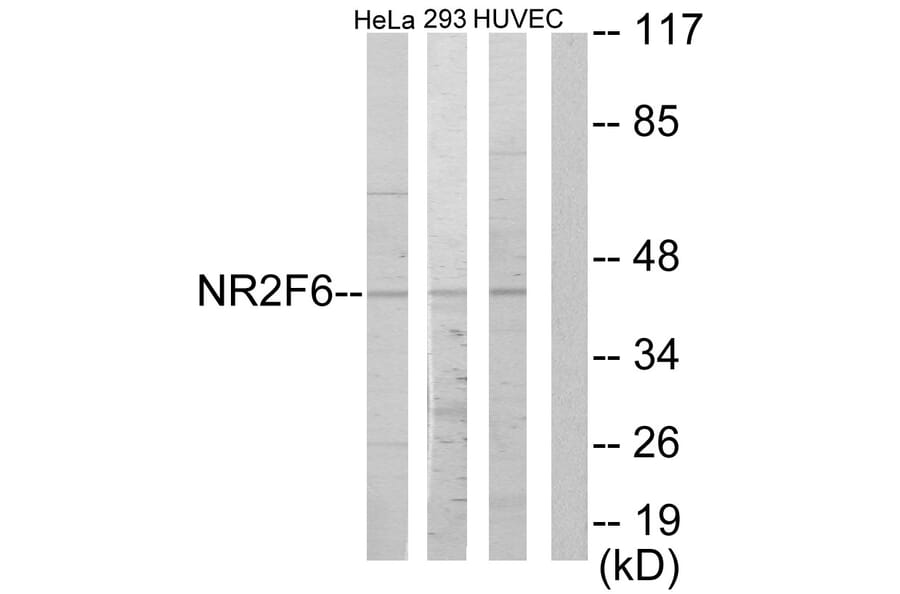 Western Blot - Anti-NR2F6 Antibody (C10336) - Antibodies.com