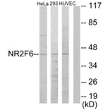 Western Blot - Anti-NR2F6 Antibody (C10336) - Antibodies.com