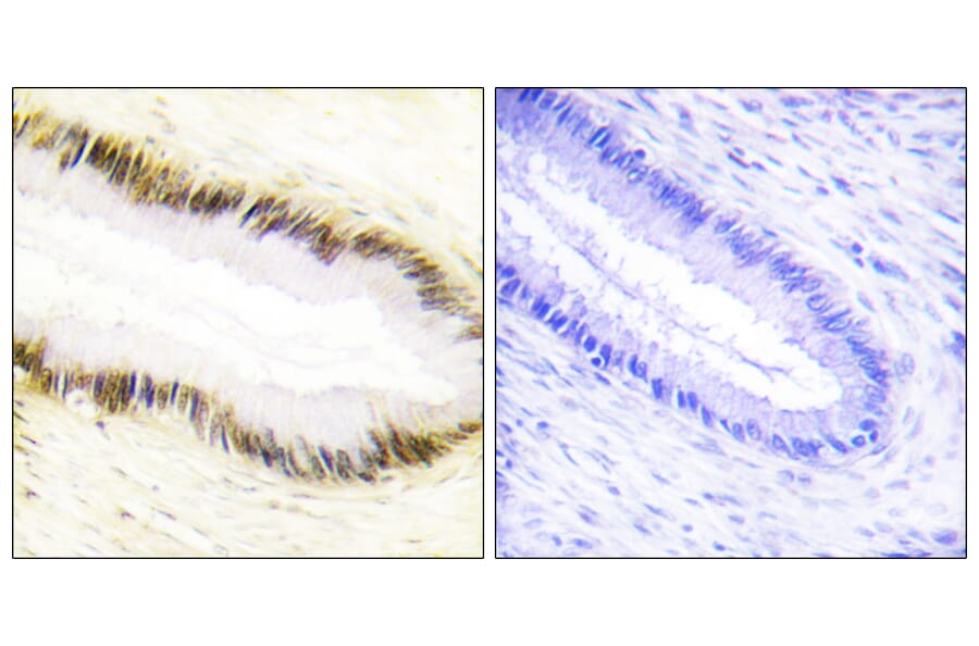Immunohistochemistry - Anti-NR2F6 Antibody (C10336) - Antibodies.com