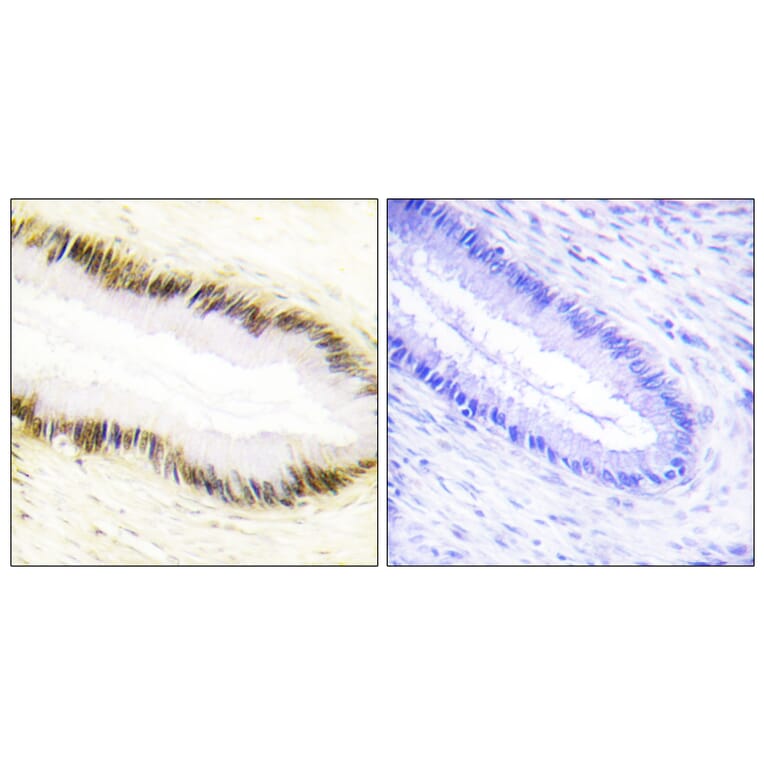 Immunohistochemistry - Anti-NR2F6 Antibody (C10336) - Antibodies.com