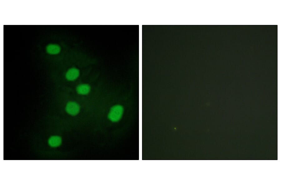 Immunofluorescence - Anti-NR2F6 Antibody (C10336) - Antibodies.com