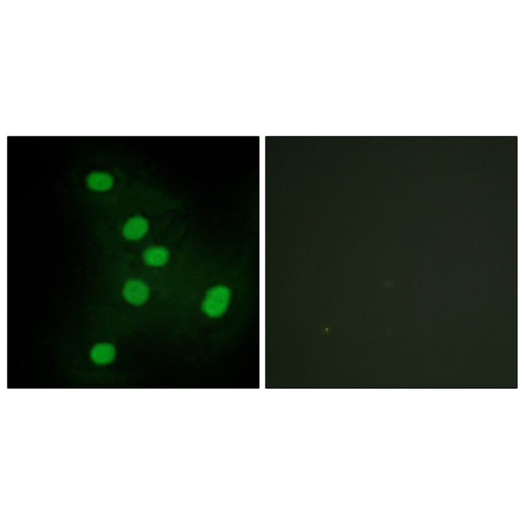 Immunofluorescence - Anti-NR2F6 Antibody (C10336) - Antibodies.com