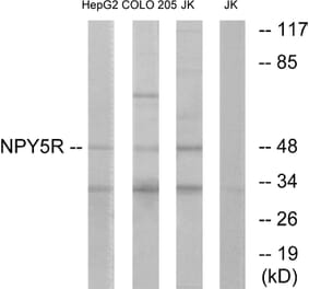 Western Blot - Anti-NPY5R Antibody (G412) - Antibodies.com
