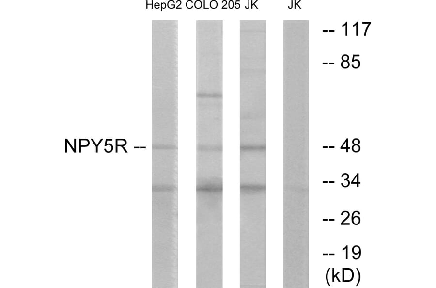 Western Blot - Anti-NPY5R Antibody (G412) - Antibodies.com