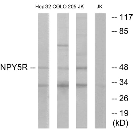 Western Blot - Anti-NPY5R Antibody (G412) - Antibodies.com
