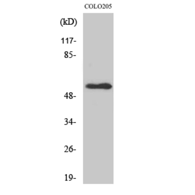 Western Blot - Anti-NPY5R Antibody (G412) - Antibodies.com