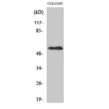 Western Blot - Anti-NPY5R Antibody (G412) - Antibodies.com