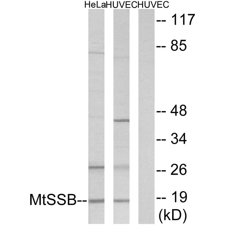 Western Blot - Anti-MtSSB Antibody (C10880) - Antibodies.com