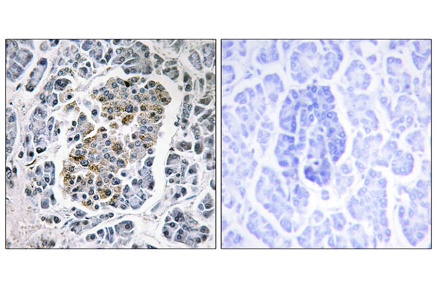 Immunohistochemistry - Anti-MtSSB Antibody (C10880) - Antibodies.com