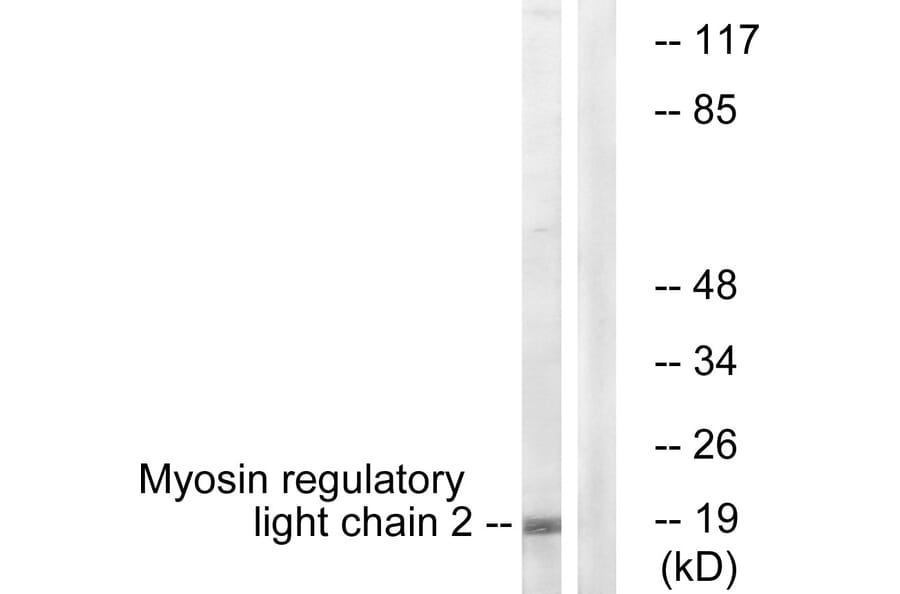 Western Blot - Anti-MRLC2 Antibody (B0690) - Antibodies.com