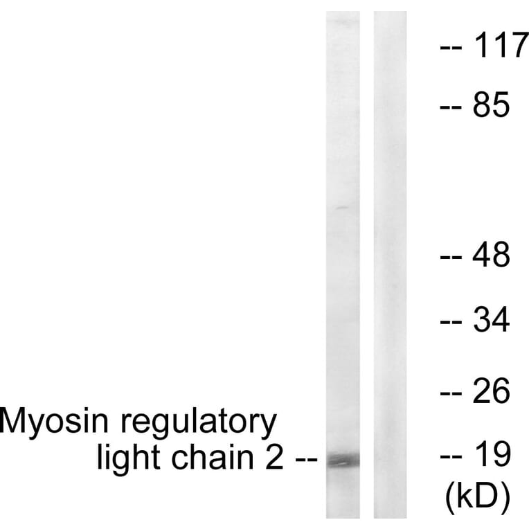 Western Blot - Anti-MRLC2 Antibody (B0690) - Antibodies.com