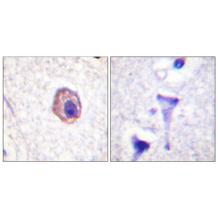 Immunohistochemistry - Anti-MRLC2 Antibody (B0690) - Antibodies.com