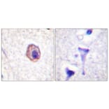 Immunohistochemistry - Anti-MRLC2 Antibody (B0690) - Antibodies.com