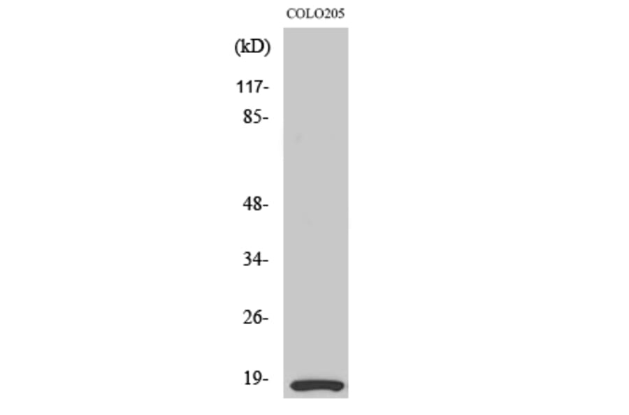 Western Blot - Anti-MRLC2 Antibody (B0690) - Antibodies.com