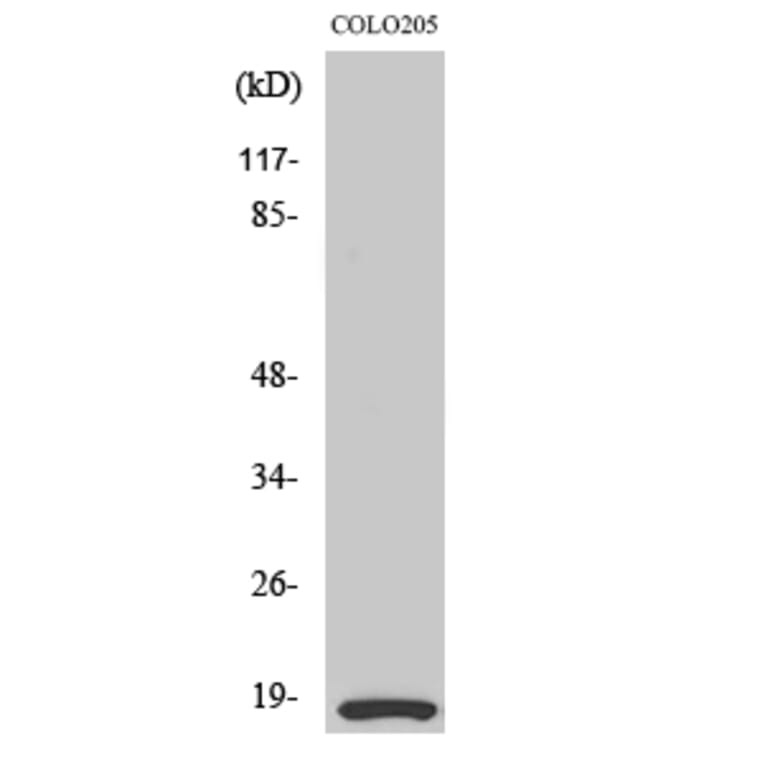 Western Blot - Anti-MRLC2 Antibody (B0690) - Antibodies.com