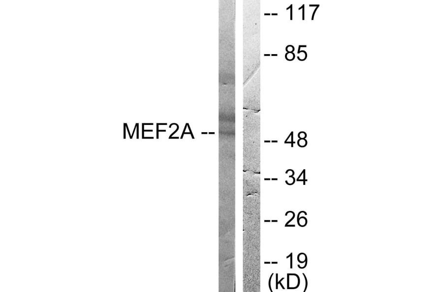 Western Blot - Anti-MEF2A Antibody (B0019) - Antibodies.com