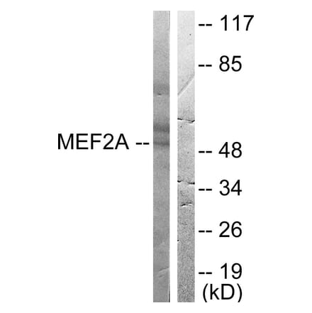 Western Blot - Anti-MEF2A Antibody (B0019) - Antibodies.com