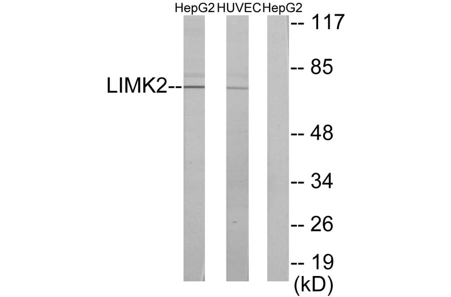 Western Blot - Anti-LIMK2 Antibody (C10720) - Antibodies.com