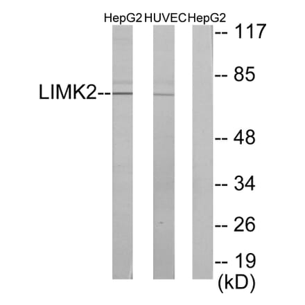 Western Blot - Anti-LIMK2 Antibody (C10720) - Antibodies.com
