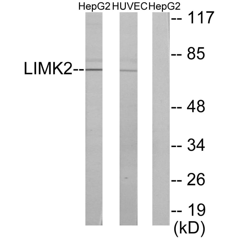 Western Blot - Anti-LIMK2 Antibody (C10720) - Antibodies.com