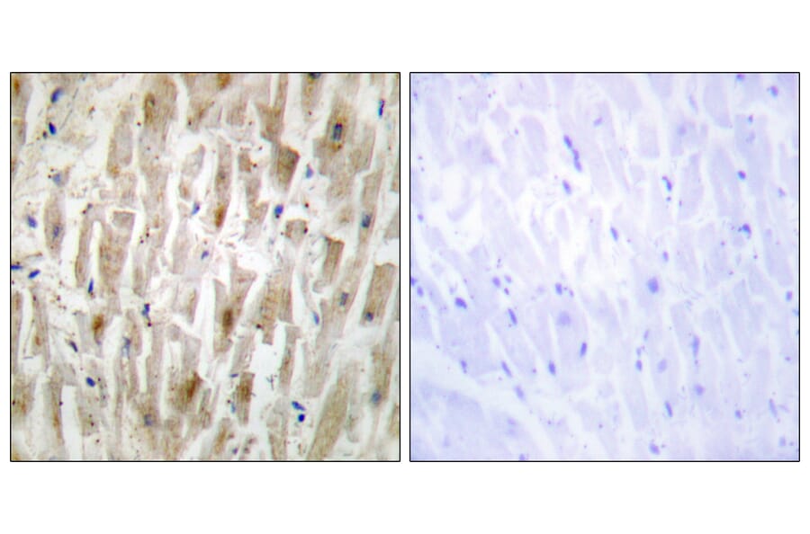 Immunohistochemistry - Anti-LIMK2 Antibody (C10720) - Antibodies.com