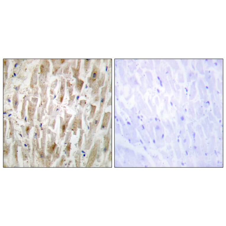 Immunohistochemistry - Anti-LIMK2 Antibody (C10720) - Antibodies.com