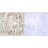 Immunohistochemistry - Anti-LIMK2 Antibody (C10720) - Antibodies.com