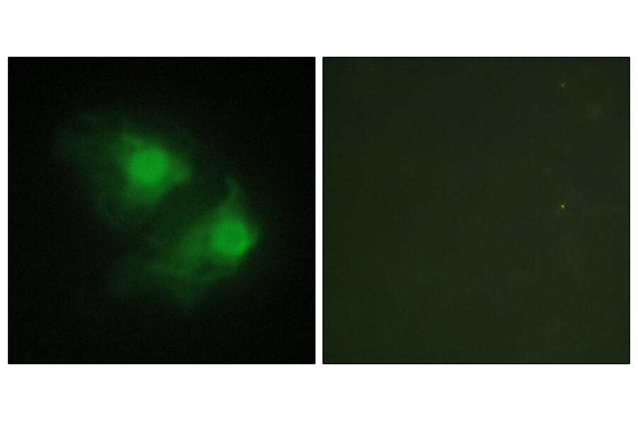 Immunofluorescence - Anti-LIMK2 Antibody (C10720) - Antibodies.com