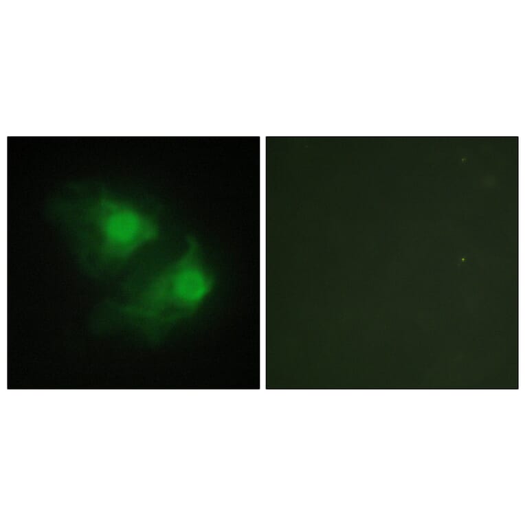 Immunofluorescence - Anti-LIMK2 Antibody (C10720) - Antibodies.com