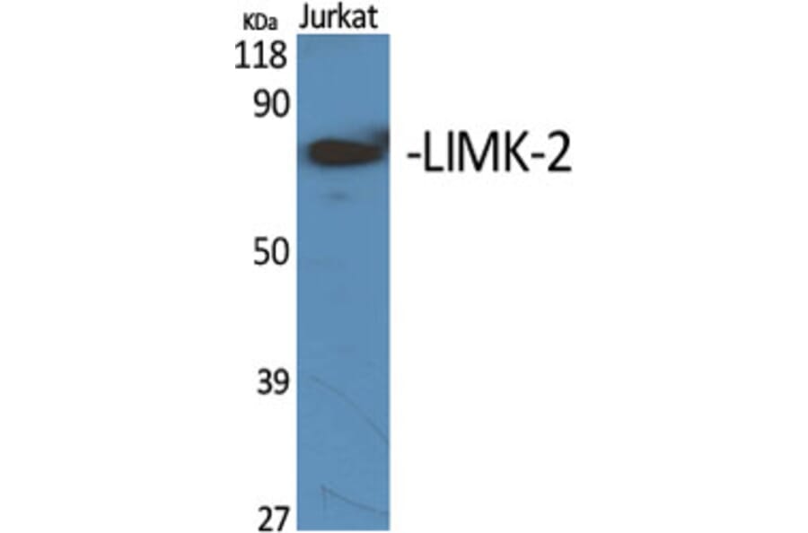 Western Blot - Anti-LIMK2 Antibody (C10720) - Antibodies.com