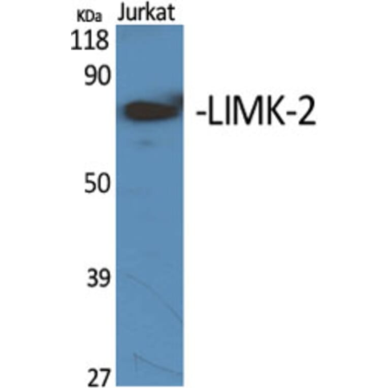 Western Blot - Anti-LIMK2 Antibody (C10720) - Antibodies.com