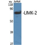 Western Blot - Anti-LIMK2 Antibody (C10720) - Antibodies.com