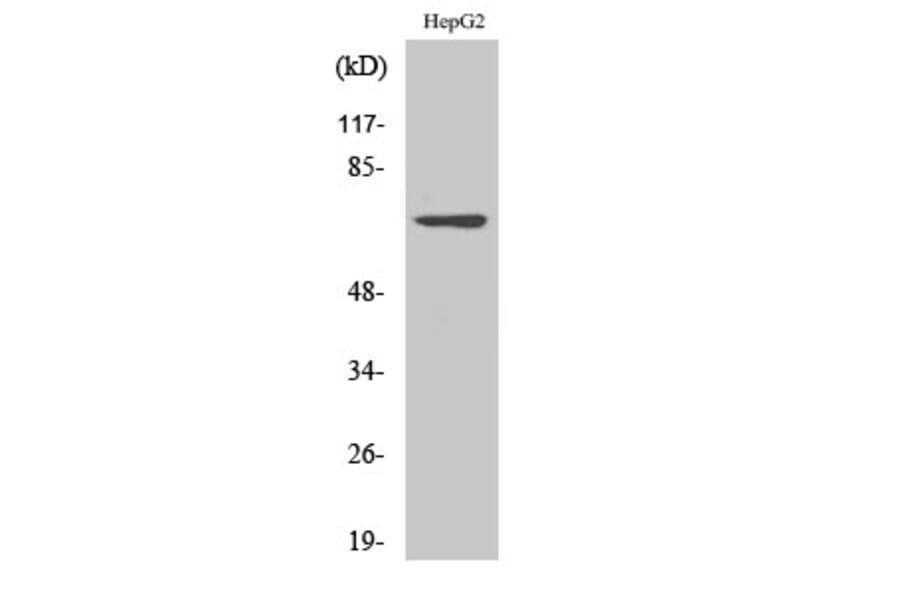 Western Blot - Anti-LIMK2 Antibody (C10720) - Antibodies.com