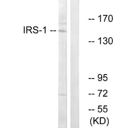 Western Blot - Anti-IRS-1 Antibody (B7121) - Antibodies.com