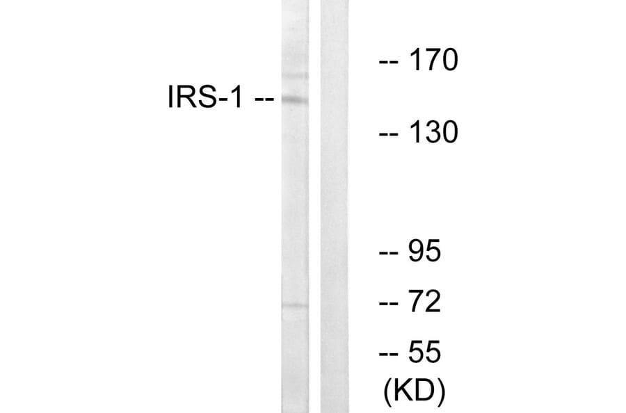Western Blot - Anti-IRS-1 Antibody (B7121) - Antibodies.com