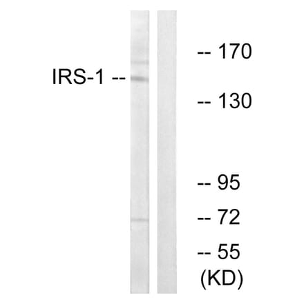 Western Blot - Anti-IRS-1 Antibody (B7121) - Antibodies.com