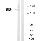 Western Blot - Anti-IRS-1 Antibody (B7121) - Antibodies.com