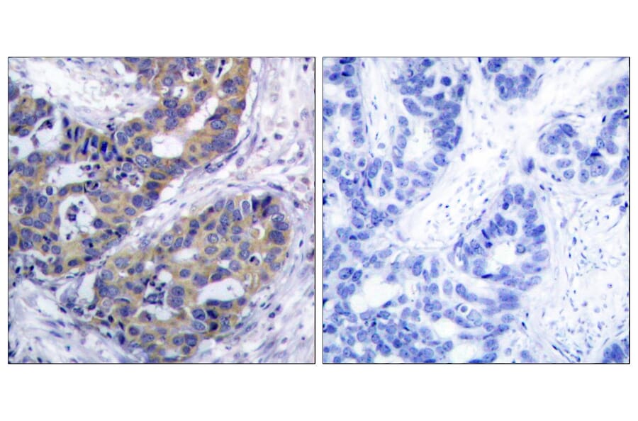 Immunohistochemistry - Anti-IRS-1 Antibody (B7121) - Antibodies.com