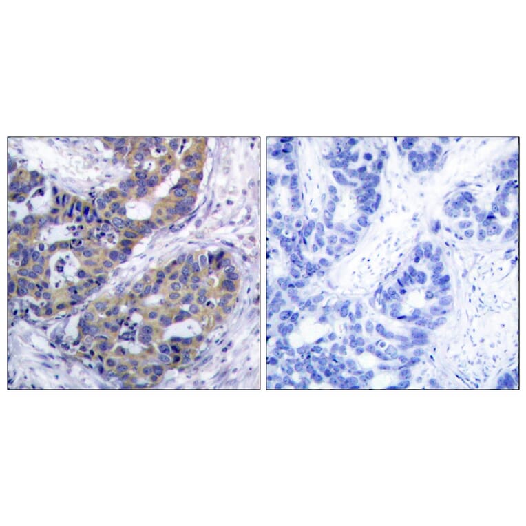 Immunohistochemistry - Anti-IRS-1 Antibody (B7121) - Antibodies.com