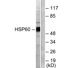 Western Blot - Anti-HSP60 Antibody (C0233) - Antibodies.com