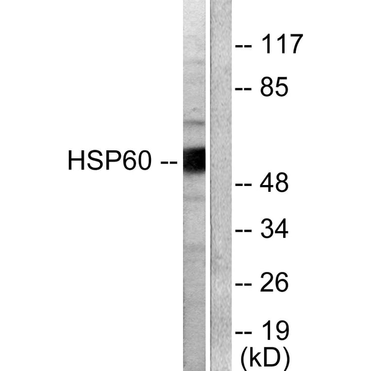Western Blot - Anti-HSP60 Antibody (C0233) - Antibodies.com